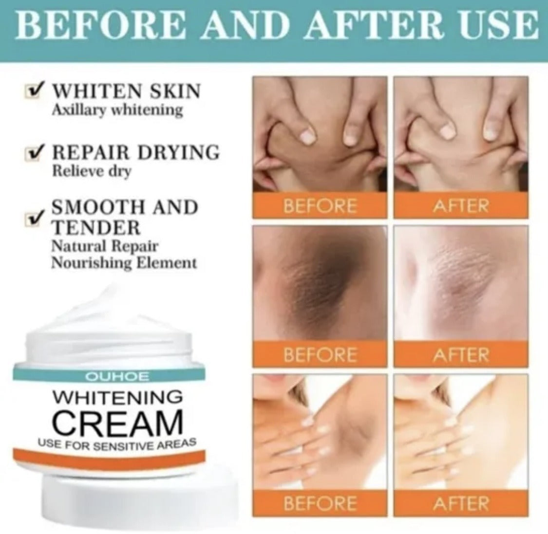 Sensitive Area Whitening Cream for Private Parts